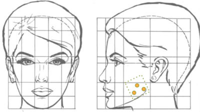 Tóxina-Botulinica-Afinamiento-de-rostro
